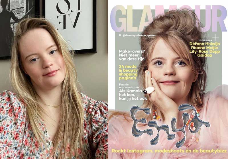 Enya é a primeira influenciadora com Síndrome de Down na Holanda a estampar uma capa de revista - Foto: reprodução Instagram downsyndrome_queen
