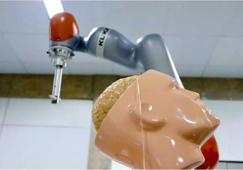 O robô neurocirurgião deixará os procedimentos mais precisos e ágeis. - Foto: reprodução USP