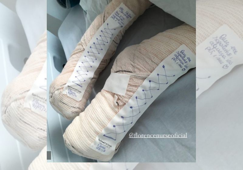 Sapatinhos para aquecer pés de uma paciente - Foto: reprodução / Instagram