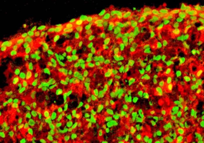 Imagem da célula beta do pâncreas - Método SALK Foto: Instituto Salk