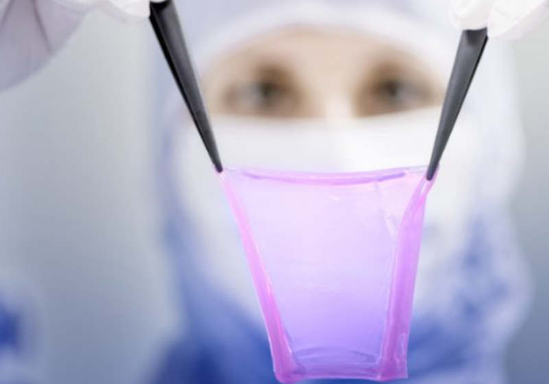 Ela é capaz de criar um enxerto de pele do tamanho de uma tampa de bueiro - Foto: reprodução