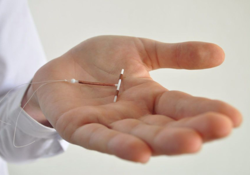 Novo DIU de cobre está em fase 1 de testes em humanos - Foto: Pixabay