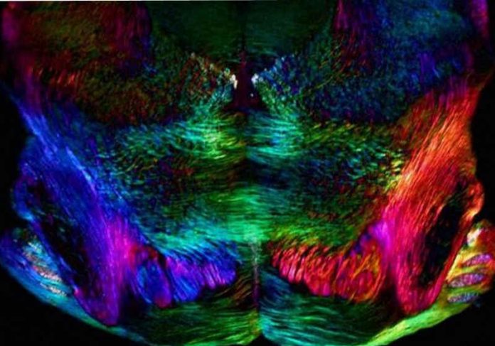 Embora o estudo tenha sido feito em cobaias - a foto mostra neurônios de camundongos - o mesmo mecanismo ocorre em humanos. Foto: University of Cambridge]