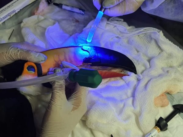Implante sendo aplicado em Miguel - Foto: reprodução