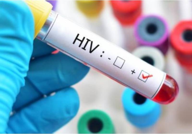 A Faculdade de Medicina e HC da USP integram uma rede mundial para descobrir cura do HIV - Foto: reprodução