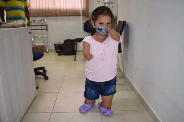 Raísa antes das próteses - Foto: Assessoria Apae