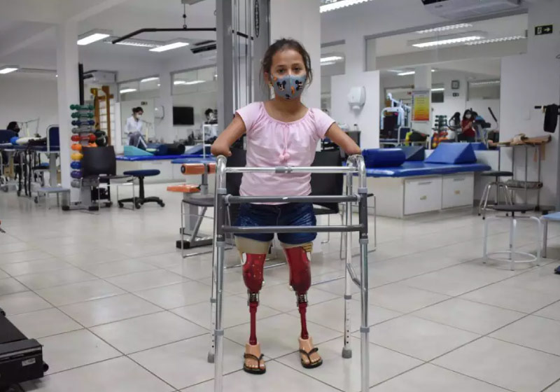 Raísa com as próteses que ganhou da Mulher Maravilha, personalizadas -Foto: Assessoria Apae