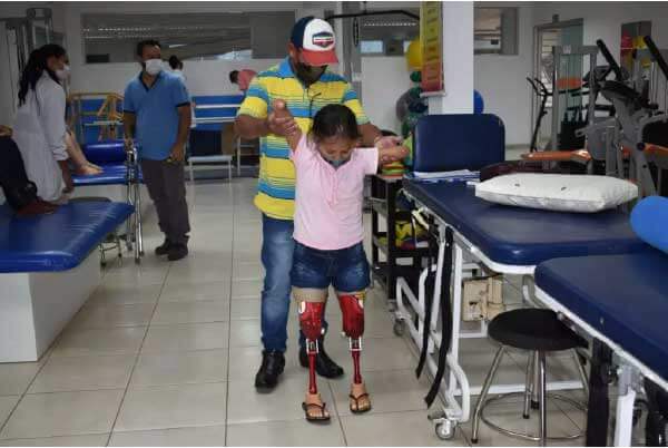 Pai ajuda a filha na adaptação das próteses - Foto: Assessoria Apae