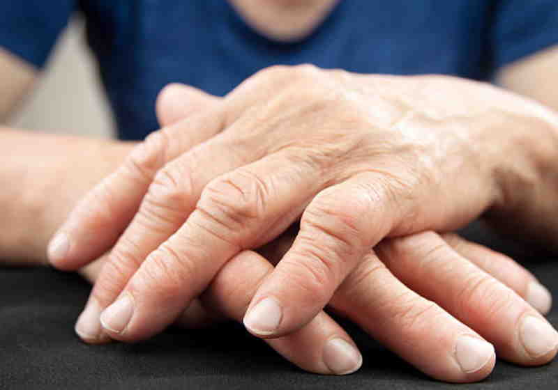 O imunizante à base de proteína pode ser promessa para prevenir artrite reumatoide - Foto: pixabay