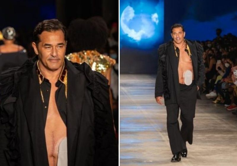 Luciano Szafir desfila na SPFW com bolsa de estomia