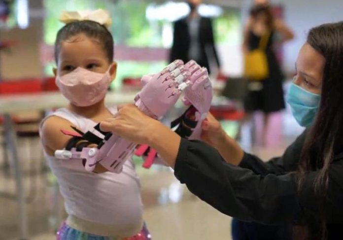 Maria Beattriz recebeu a próteses de mão em 3D, feita pelos alunos do IESB, na cor que ela pediu : rosa - Foto: IESB/Divulgação