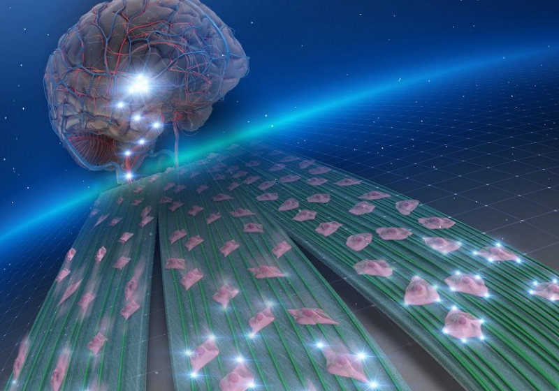 A plataforma baseada em nanofibras, na prática, aprisiona as células de câncer no cérebro como estratégia terapêutica Foto: ACS Applied Bio Materials/ACS