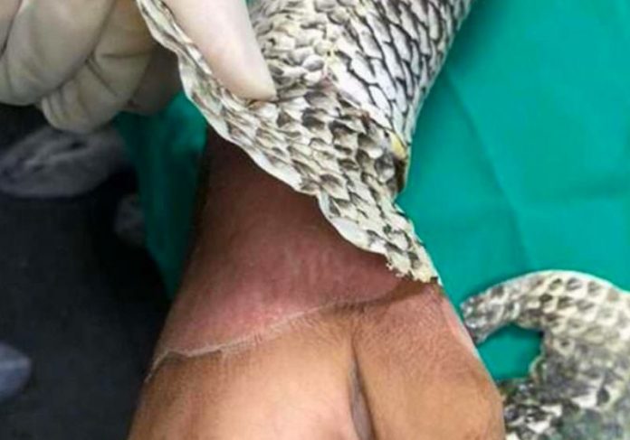 Os estudos brasileiros com pele de tilápia para tratar queimaduras, feridas e outros ganharam 3 prêmios em novembro - Foto: divulgação