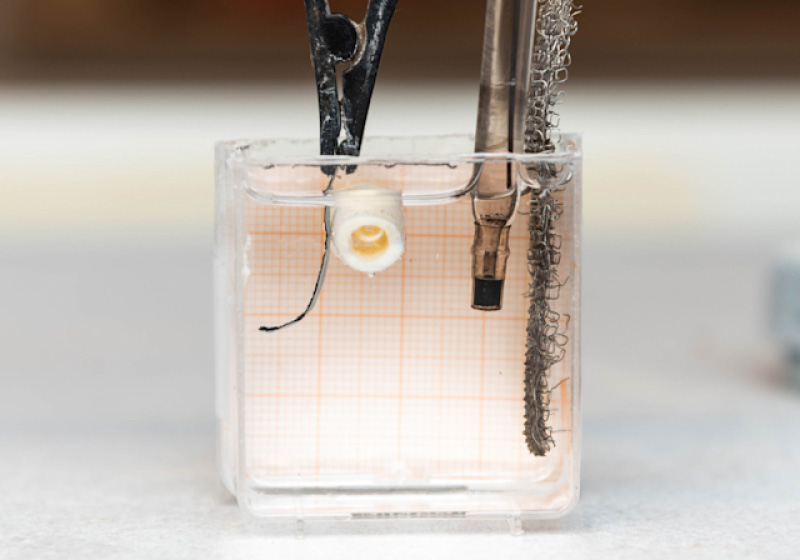 O microrrobô injetável promete restaurar ossos em poucos dias - Foto: Olov Planthaber