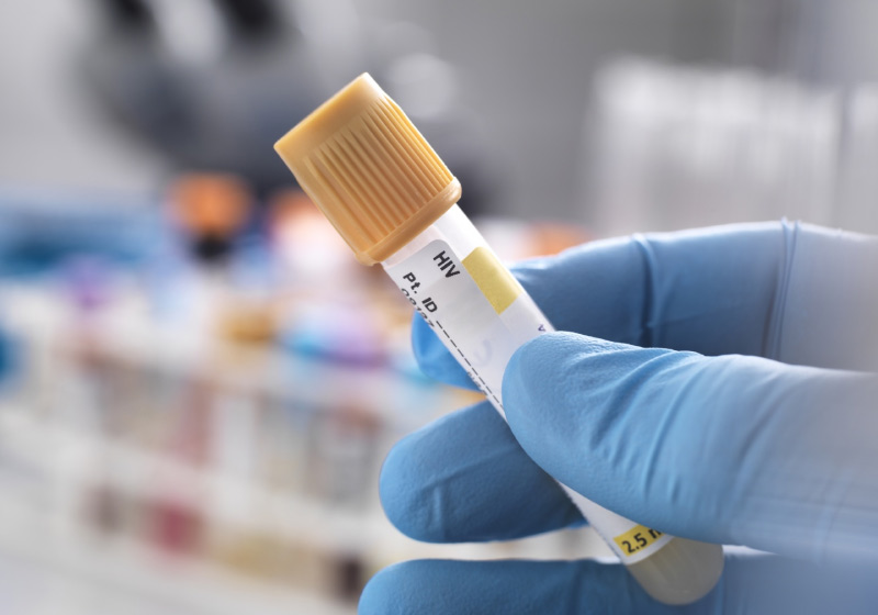 Uma paciente de Nova Iorque foi curada da HIV após receber um tratamento inovador, a partir de células-tronco - Foto: Getty Images