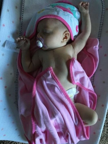 Everly ainda bebê após a primeira cirurgia - Foto: arquivo pessoal