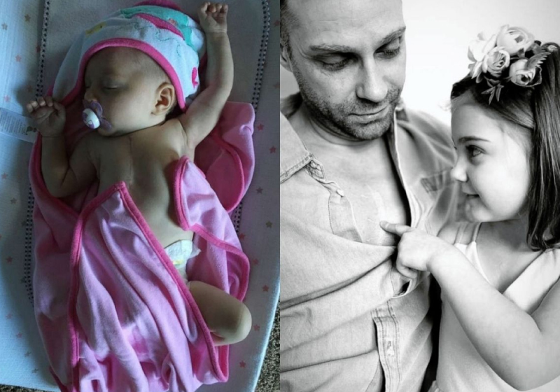 O pai decidiu tatuar uma cicatriz no peito para que a filha não se sentisse diferente - Foto: arquivo pessoal