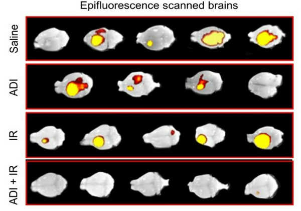 Os tumores desapareceram completamente Foto: Nabil Hajji 