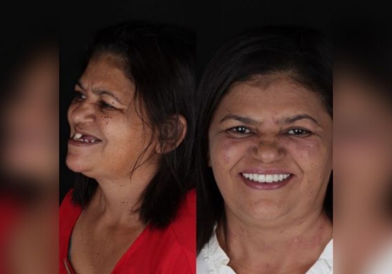 “Me sinto outra mulher, realizada. Não tenho mais vergonha de mim mesma”, disse dona Rose após arrumar os dentes. Fotos: Reprodução/vídeo