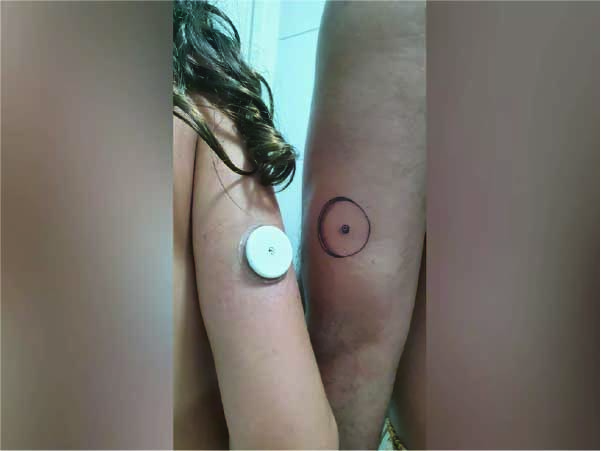 O pai tatuou o sensor que a filha usa por ser diabética - Foto: arquivo pessoal