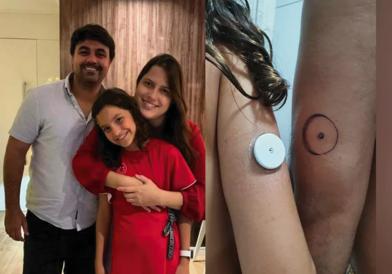 O pai tatuou o sensor de glicose, igual ao da filha, por ela estar se sentindo excluída - Foto: arquivo pessoal