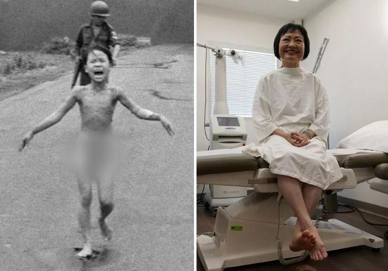 A boa notícia é que hoje, aos 59 anos de idade, ela está bem e após 50 anos do atentado, passou pelo último tratamento. Foto: Lynne Sladky/AP