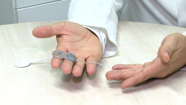 O implante coclear é feito pelo SUS - Foto: reprodução
