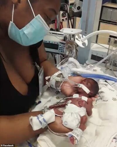 Autumn nasceu com apenas meio quilo - Foto: arquivo pessoal