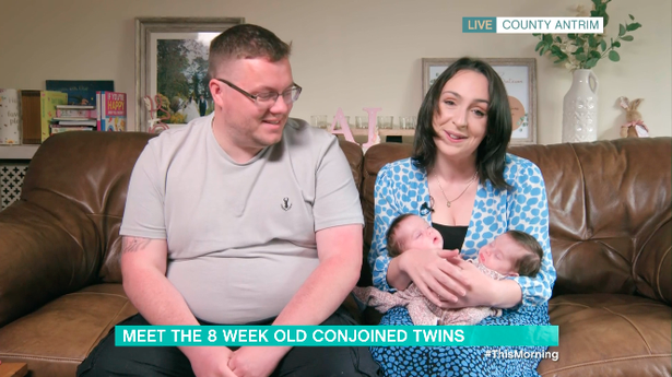 Na 12ª semana de gestação, foi identificado no ultrassom que as gêmeas estavam unidas. Foto: Arquivo Pessoal