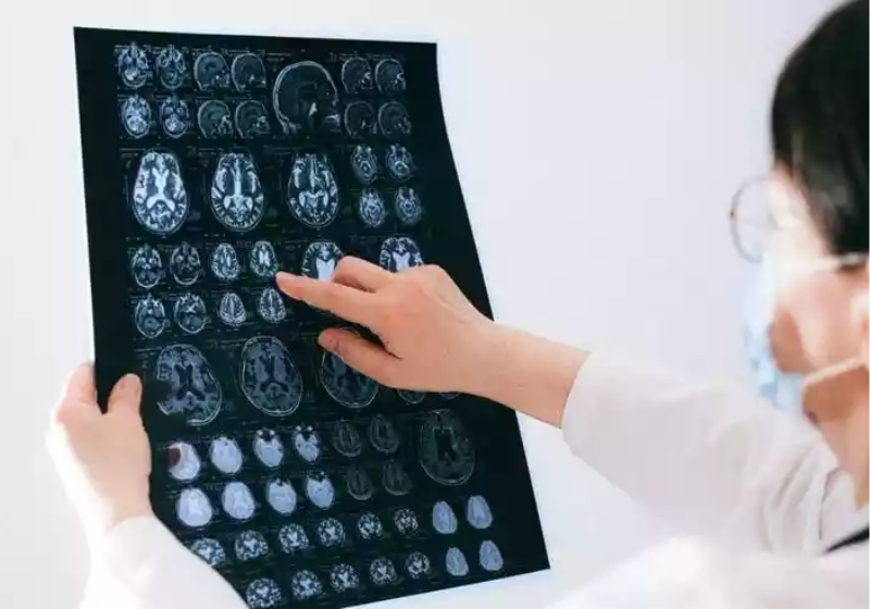 Estudos confirmam que a creatina pode ajudar na recuperação de traumas no cérebro e a melhorar a memória - Foto: Reprodução