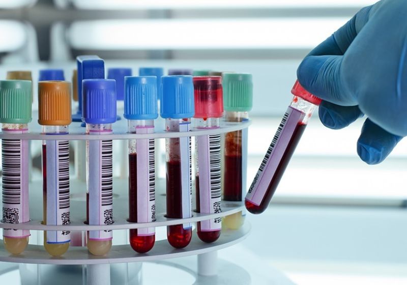 O teste de sangue pode detectar o câncer e também identificar de onde vem o sinal dele no corpo. Foto: Reprodução