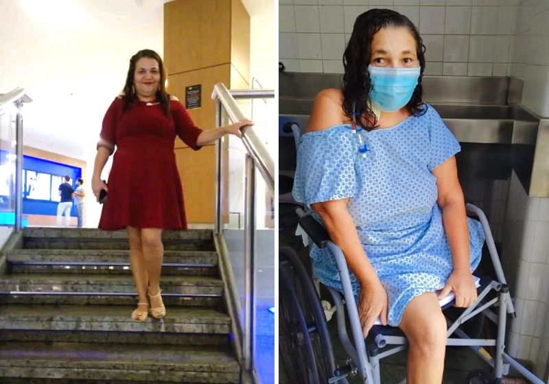 Há 1 ano em cadeira de rodas após amputar a perna, ela não consegue mais trabalhar e precisa de ajuda. Fotos: Arquivo Pessoal