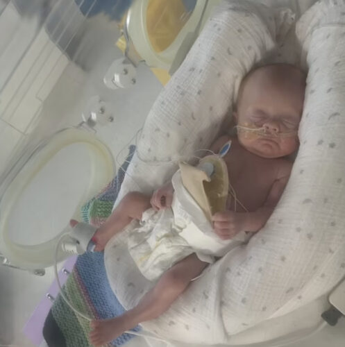O bebê segue internado - Foto: Daily Mail