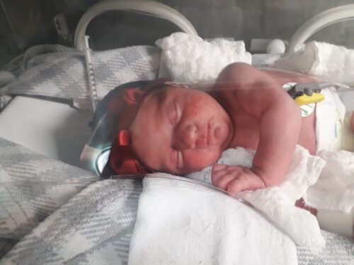 Manu nasceu com apenas 30 semanas de gestação - Foto: reprodução Instagram @minha_nunu