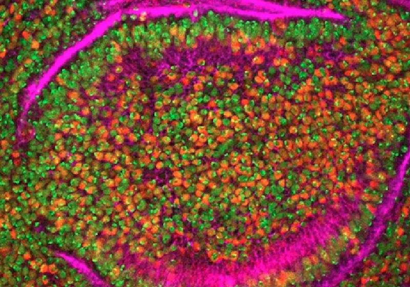 Pesquisadores japoneses desenvolvem experiência que mata células do câncer com DNA artificial. Foto: National Cancer Institute