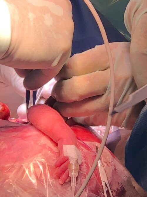 Rafael recebeu os medicamentos durante a operação. Foto: Reprodução