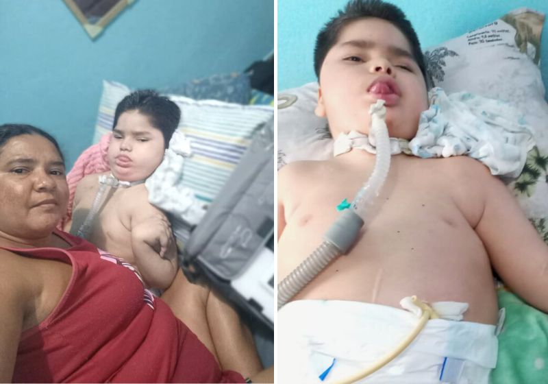 Um empresário viu o drama do menino José Calebe, de 8 anos, e doou o aparelho que o menino precisa para respirar. Fotos: Arquivo Pessoal