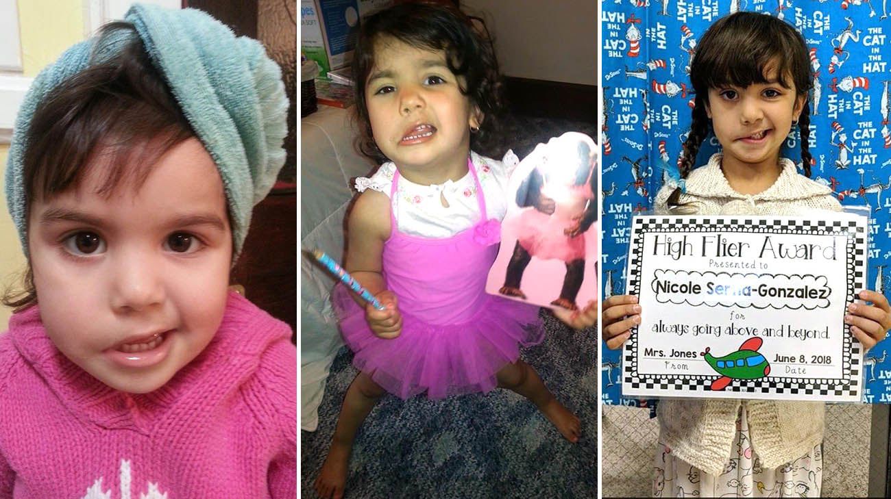 A paralisia facial impedia Nicole de sorrir e abrir os olhos - Fotos: Cleveland Clinic