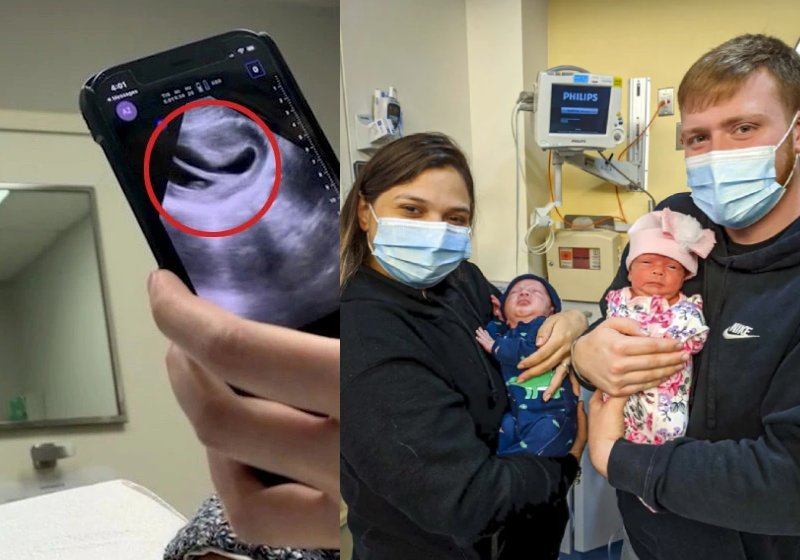 Além do útero em forma de coração ela teve gêmeos - Fotos: SWNS