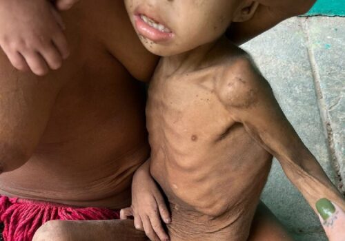 O dinheiro enviado pela Alemanha ajuda crianças e adultos Yanomami de Roraima, com fome e malária - Foto: Gabriela Mafra / Sesai / 2022