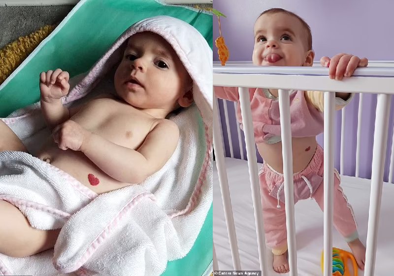 A bebê nasceu com uma marca em forma de coração na barriga e ela está cada vez mais visível - Fotos: Caters News Agency