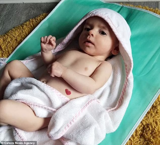 A bebê quando nasceu com a marca em forma de coração -  Foto: Caters News Agency