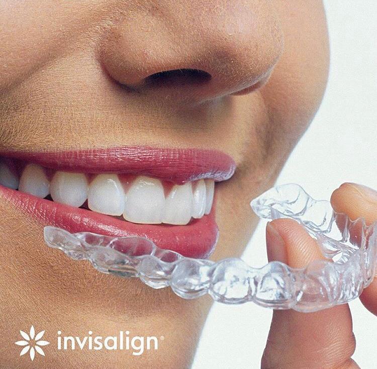 O projeto Sorriso Único é uma parceria da Invisalign com a Dra. Virna Patusco - Foto: Invisalign