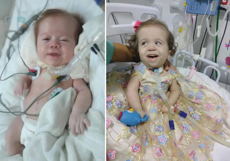 Por precisar de ventilação mecânica para viver, a bebê passou esses anos todos no Hospital Geral de Palmas. Fotos: Reprodução/Internet