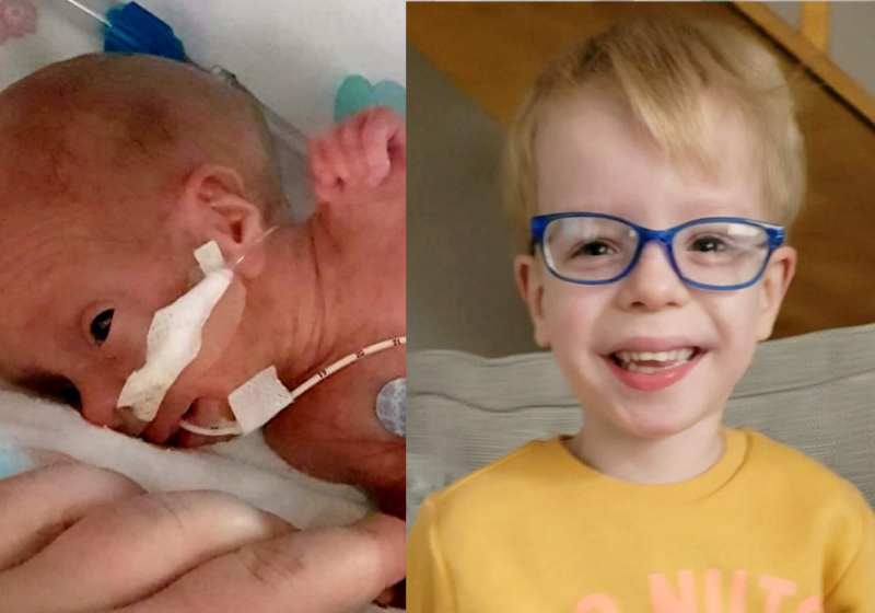 Um bebê desafiou todas as probabilidades médicas e sobrevive mesmo tendo apenas 10% de chance de vida. Hoje ele é um garoto de 4 anos super inteligente. - Foto: arquivo pessoal