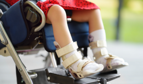 O Zolgensma é o único medicamento efetivo, capaz de interromper a AME. - Foto: Pexels