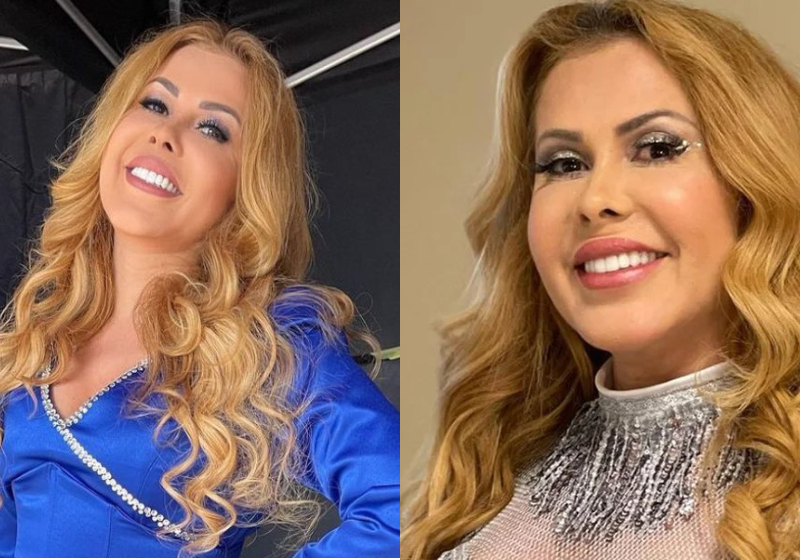 A doença da década deixou sequelas na cantora Joelma, entre elas o inchaço no rosto. Mas com muita força de vontade, cuidados e alimentação correta, a artista está de volta aos palcos - Fotos: Reprodução/@joelmaareal/Instagram.