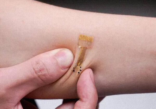 O aparelho ainda será testado em humanos, mas promete ser uma ferramenta inovadora para as próximas gerações. - Foto: Northwestern University/SWNS/Divulgação 