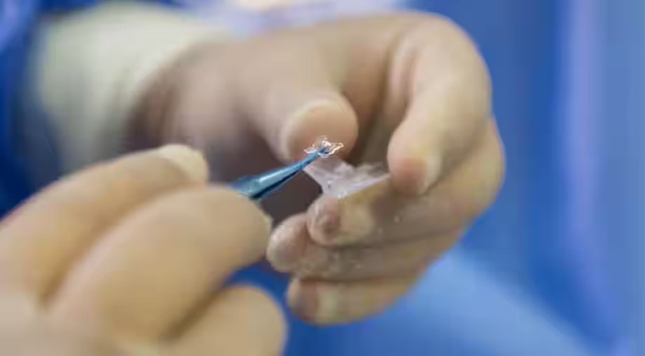 O paciente teve a visão de um olho recuperada após 40 anos sem enxergar. Foto: Reprodução/Wionews.