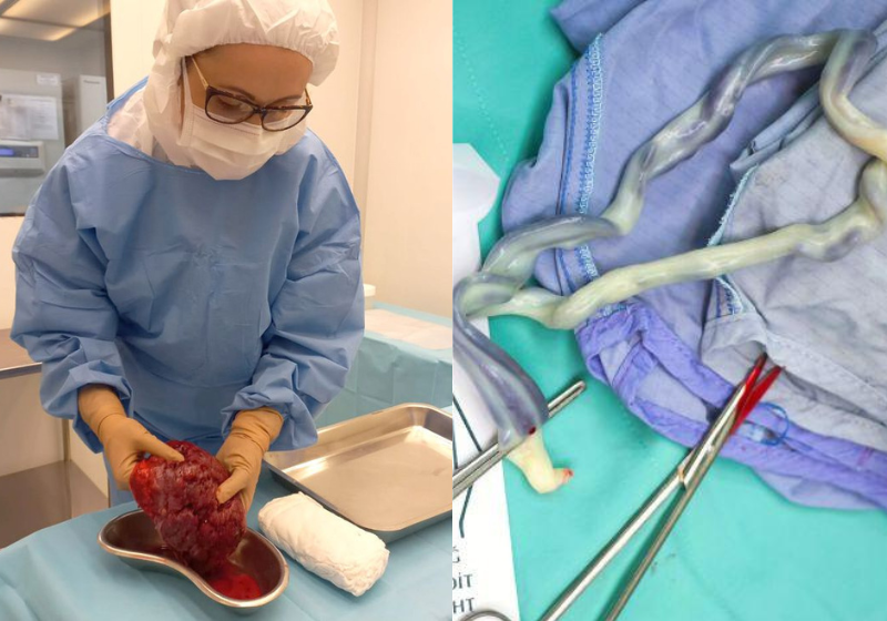 A pesquisa desenvolvida por brasileiros mostrou que é possível produzir curativos biológicos com placenta humana para curar feridas de difícil cicatrização. Foto: Reprodução/INTO e Getty Images.